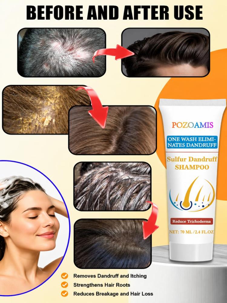 Gentle Sulfur Cleansing Shampo - Home Improvement Visualizer ulasan dan harga